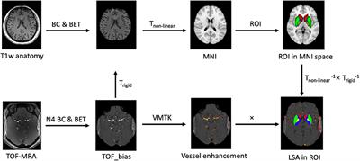 A Processing Pipeline for Quantifying Lenticulostriate Artery Vascular Volume in Subcortical Nuclei